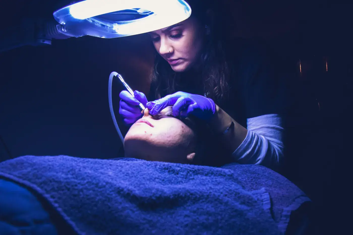 Curso de Microneedling